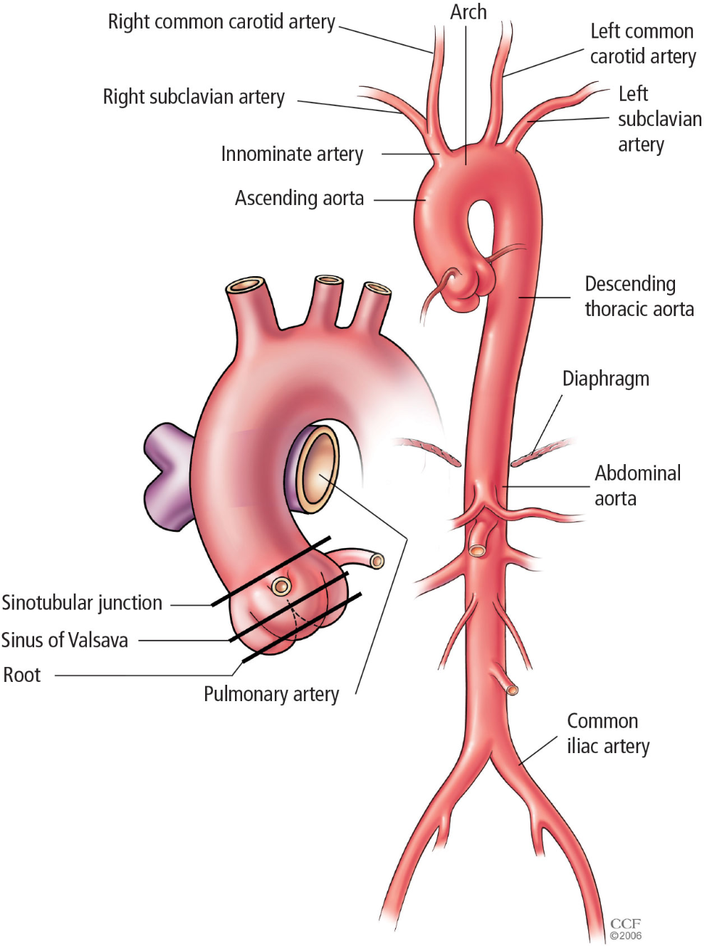 Aortic replacement in cardiac surgery ... | Medical knowledge ...