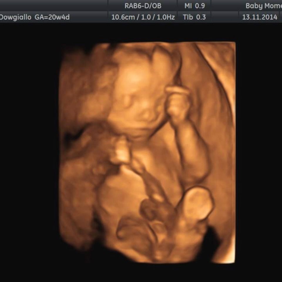 30 weeks pregnant 4d ultrasound - nibhtwc