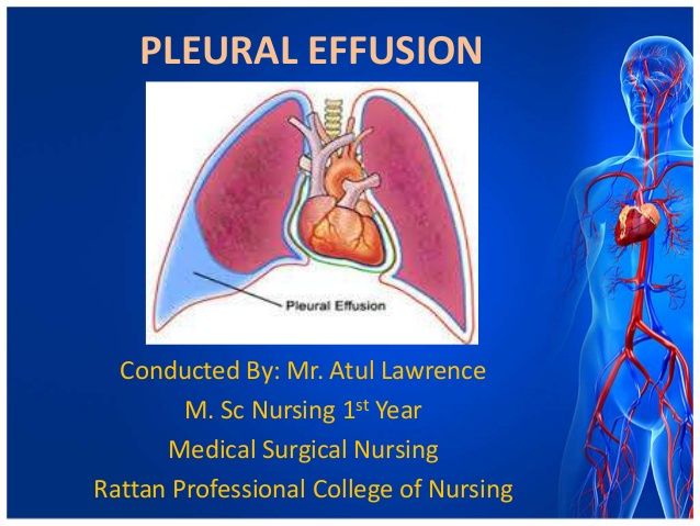 Pleural Effusion | Pleural effusion, Medical surgical nursing, Serous ...