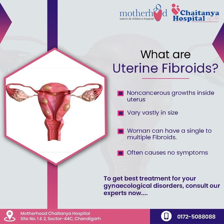 #uterinefibroids #fibroids #womenslife #womenhealth #gyneissues #gyne # ...