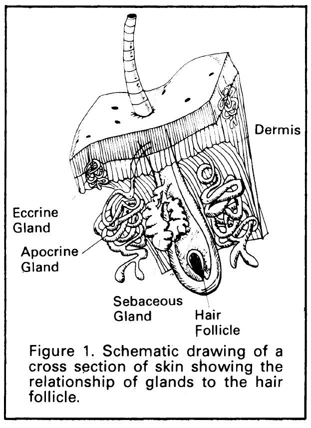 There are three stages of the disease. Stage 1 is characterized by ...