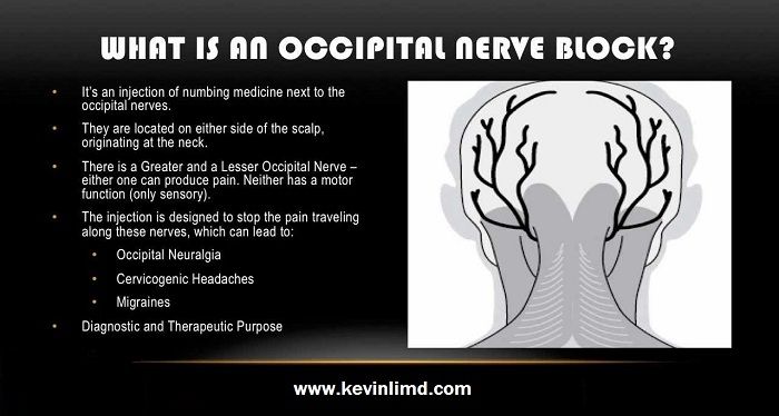 Occipital Nerve Block Injection