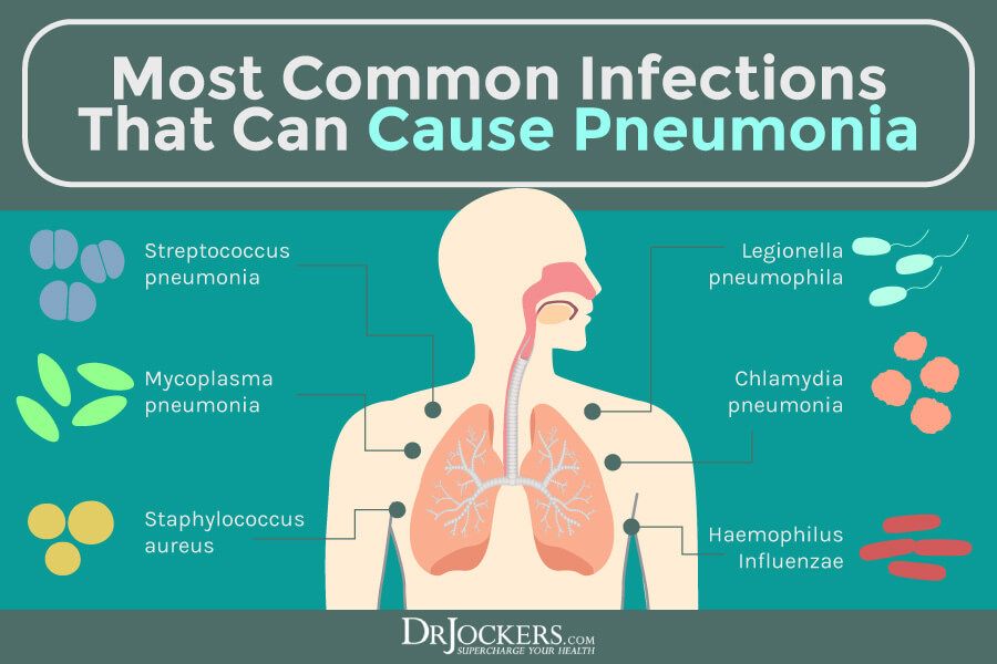 Pneumonia: Causes, Symptoms & Support Strategies - DrJockers.com ...