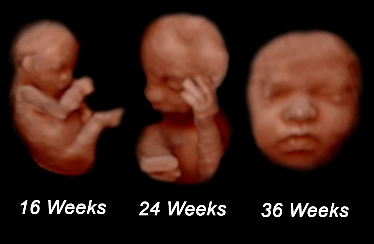 When Do You Get A 3D Ultrasound? – Hovk.org