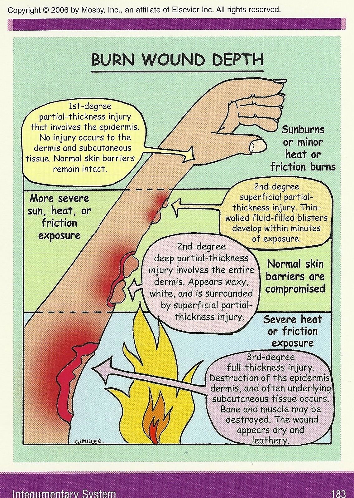 Burn Care Nurse Education And Training: A Comprehensive Guide – Learn ...