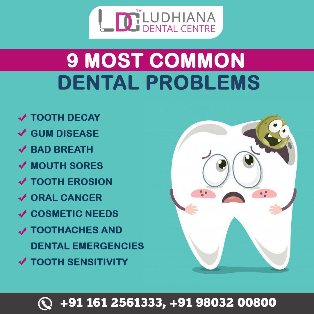 9 Most Common Dental Problems | Dental problems, Dental emergency, Dental