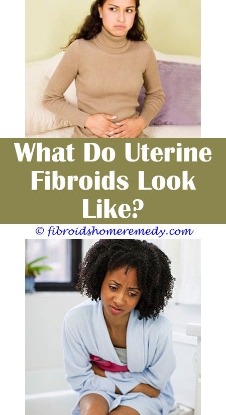 Can Ovarian Cancer Be Mistaken For Fibroids / Signs of Uterine Fibroids ...