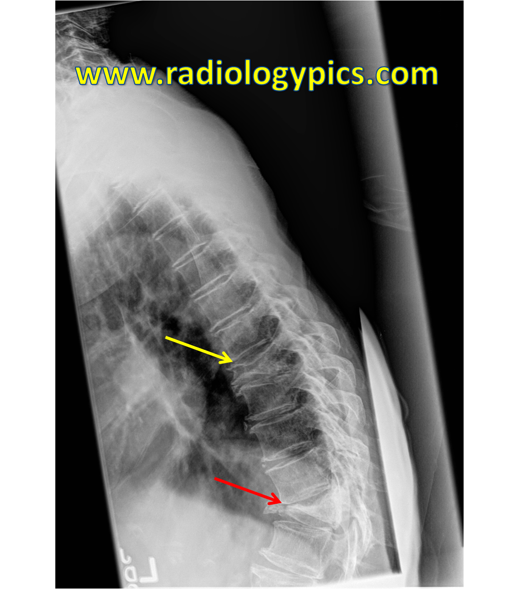 Pin on Radiographic Pathology