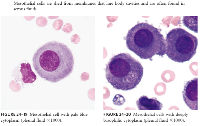 Peritoneal Fluid Cell Count | Hot Sex Picture