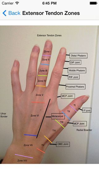 Extensor Tendon Zones Occupational Therapy Schools, Physical Therapy ...