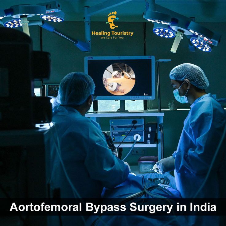 Aortofemoral Bypass Surgery in India | Bypass surgery, Surgery, Medical ...