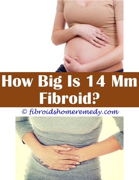 Fibroids And Bladder Issues | Fibroids, Uterine fibroids, Fibroid tumors image.