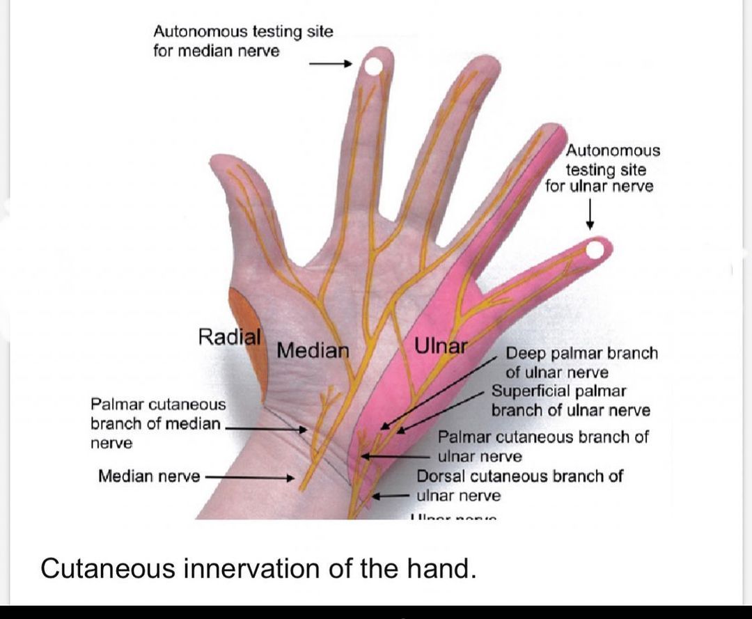 Hand Therapy Academy on Instagram: “Sensory innervation of the volar ...