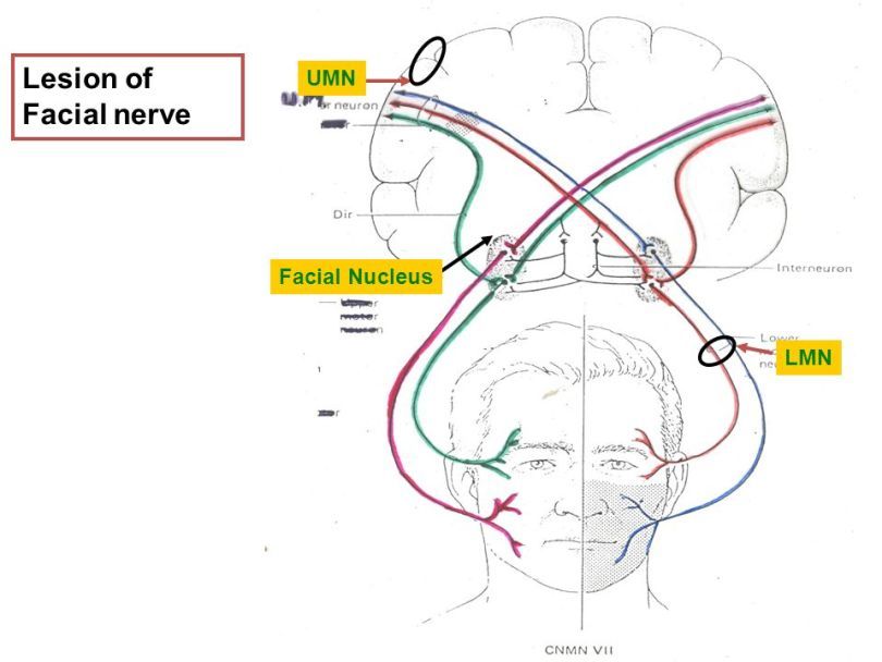 an image of the facial nervous system with labels on each side and ...