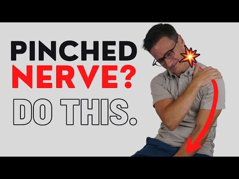 How to fix a pinched nerve in your neck cervical radiculopathy ...