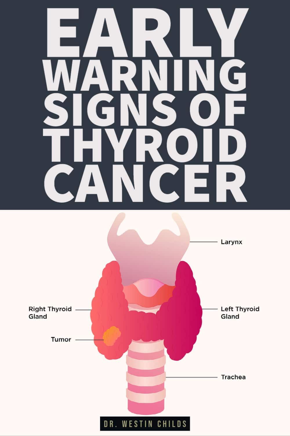 Thyroid cancer symptoms early warning signs – Artofit