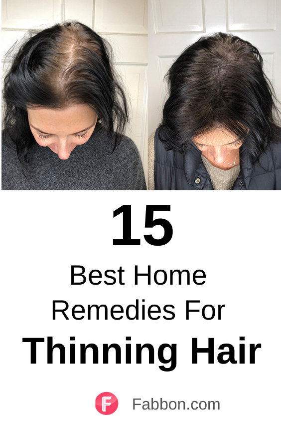 15 Proven Home Remedies For Thinning Hair Thinning hair remedies