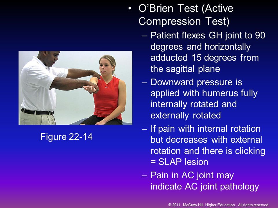 O'brien test 【 A SLAP tear or SLAP lesion is an injury to the glenoid ...