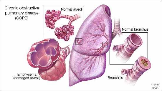 Pin on Health Conditions and Tips