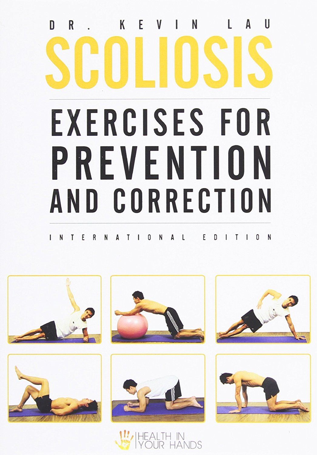 Scoliosis Strengthening Exercises