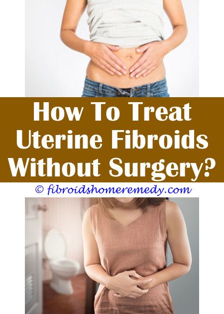 A Fibroid On My Uterus | Fibroid surgery, Uterine fibroids, Fibroids