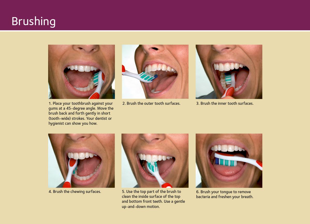 How to Brush Mayville, Dental Procedures, Dentist, Teeth, Conditioner ...