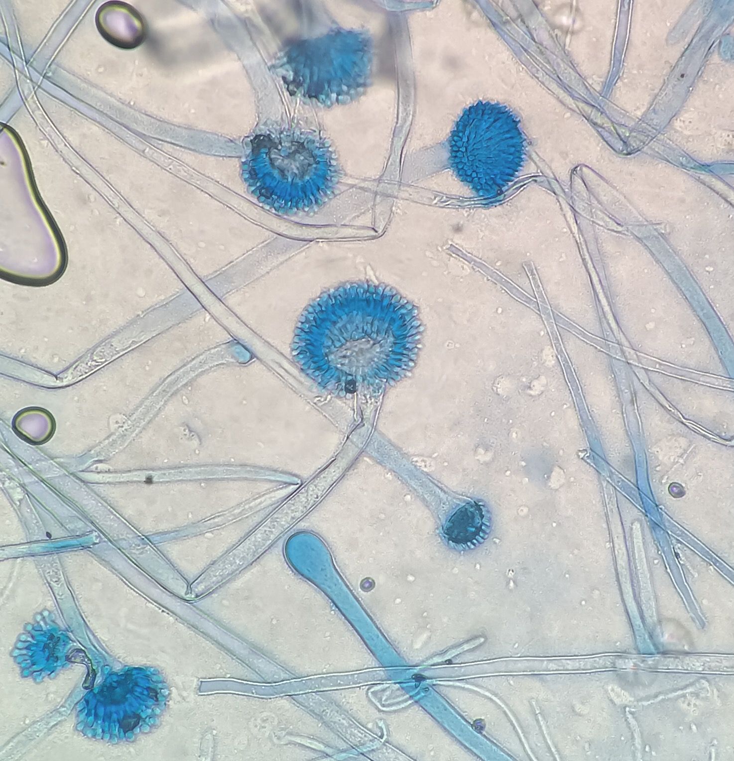 รายการ 90+ ภาพ aspergillus sp. ลักษณะ ใหม่ที่สุด – BuoiHoLo VTTN VN