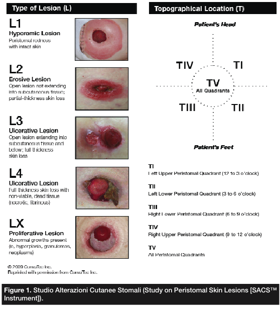 Ostomy Care Nursing Skill Template