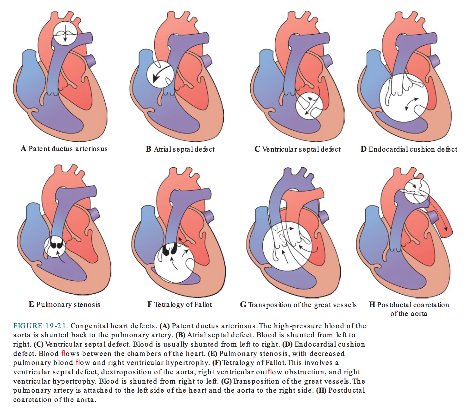 Nurse Study Notes, Nursing Study, Nursing School, Nicu Nursing ...