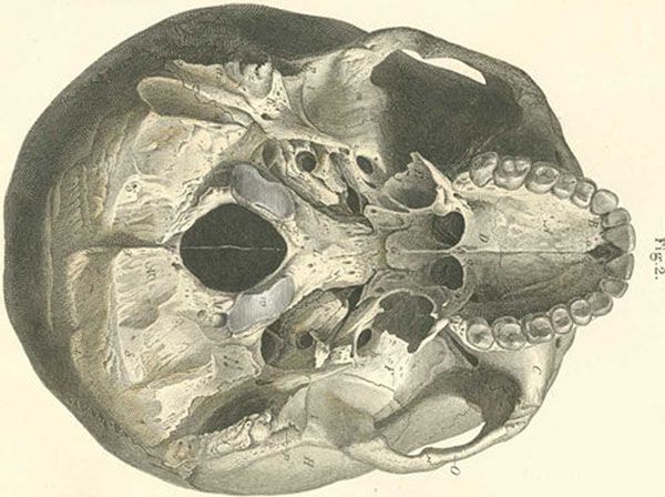 Foramen Magnum Anatomybox Skull Cranium Scientific Illustration