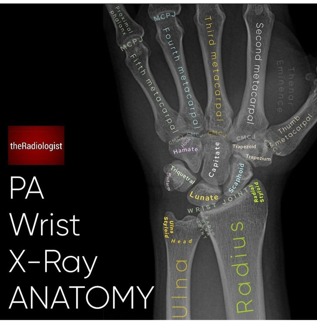 Pin by Charlotte Anne on xray anatomy | Wrist anatomy, Medical ...