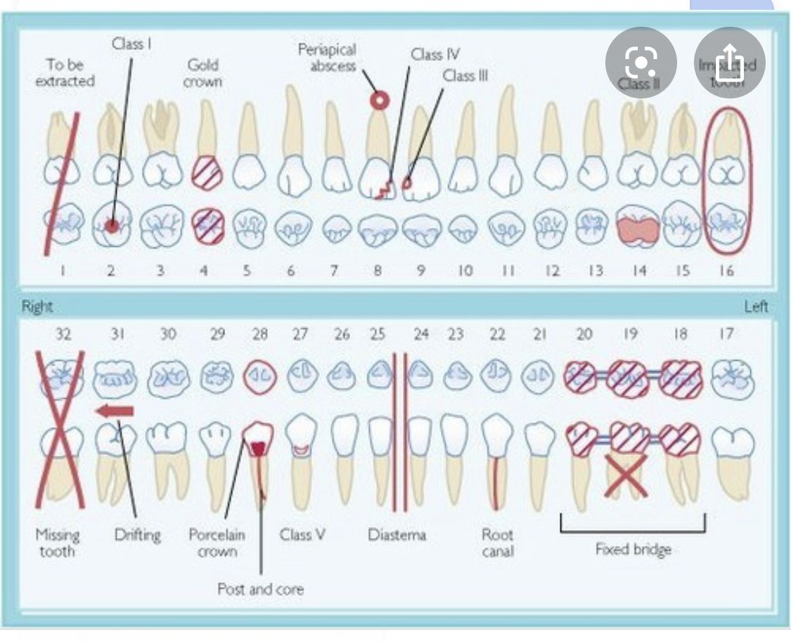 Printable Dental Charting Symbols