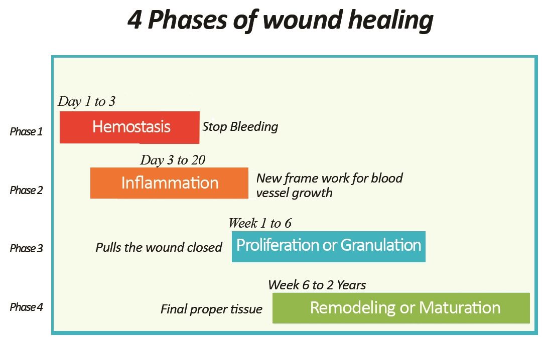 wound healing stages - Google Search | Systemic inflammation, Wound ...