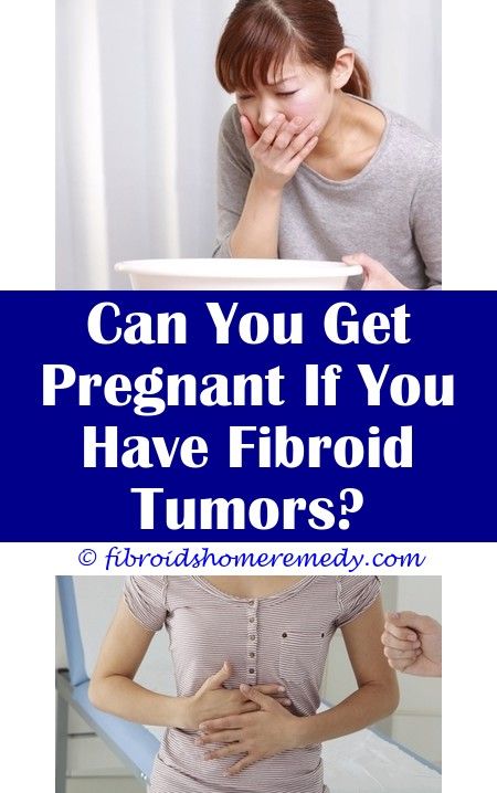 How To Stop Fibroid Bleeding | Uterine fibroids, Fibroid surgery ...