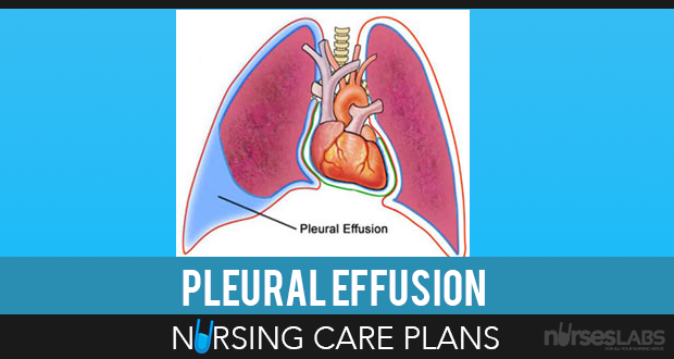 Pin on Nursing Care Plans