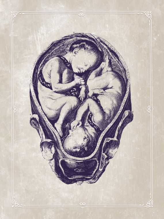 Twins Gestation Anatomy Customizable Pregnancy Illustration Womb ...