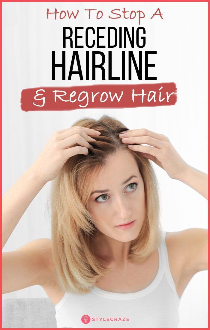 How To Stop A Receding Hairline And Regrow Hair Regrow hair naturally