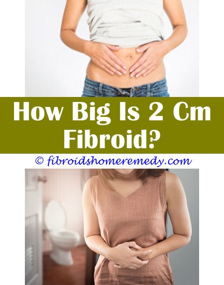 Fibroids Miracle Book Amazon | Uterine fibroids, Fibroid surgery, Fibroids