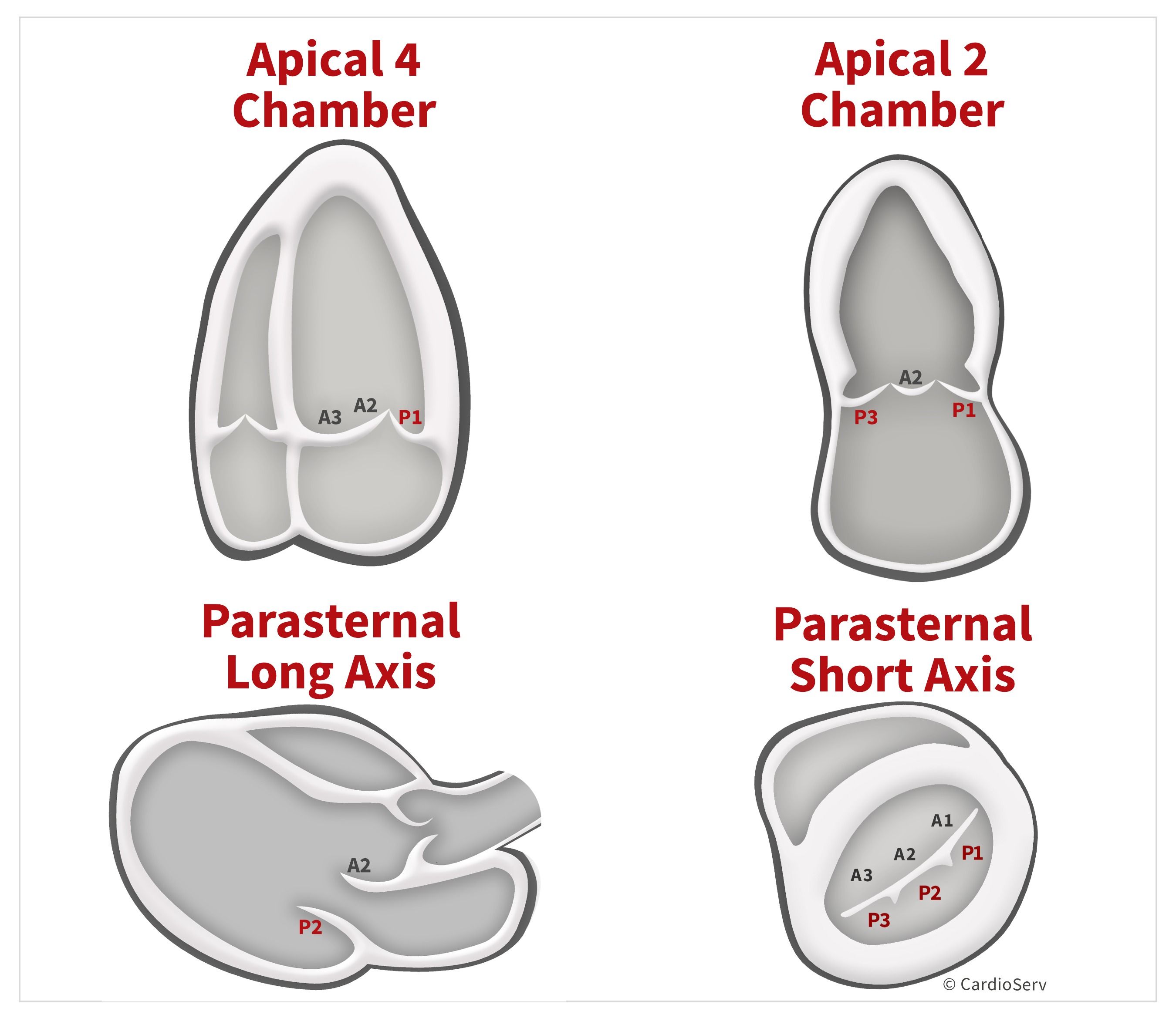 Mitral Scallops Summary Table Transthoracic Echo TTE Cardiac Sonography ...