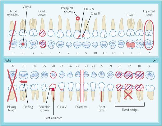 Pin on Dental humor