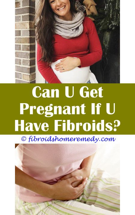 My fibroid is atypical.Dissolving fibroids symptoms.Percutaneous ...