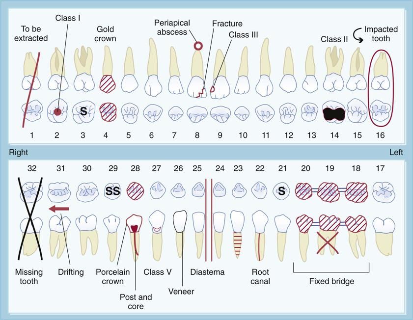 12. The Dental Examination | Dental charting, Dental assistant study