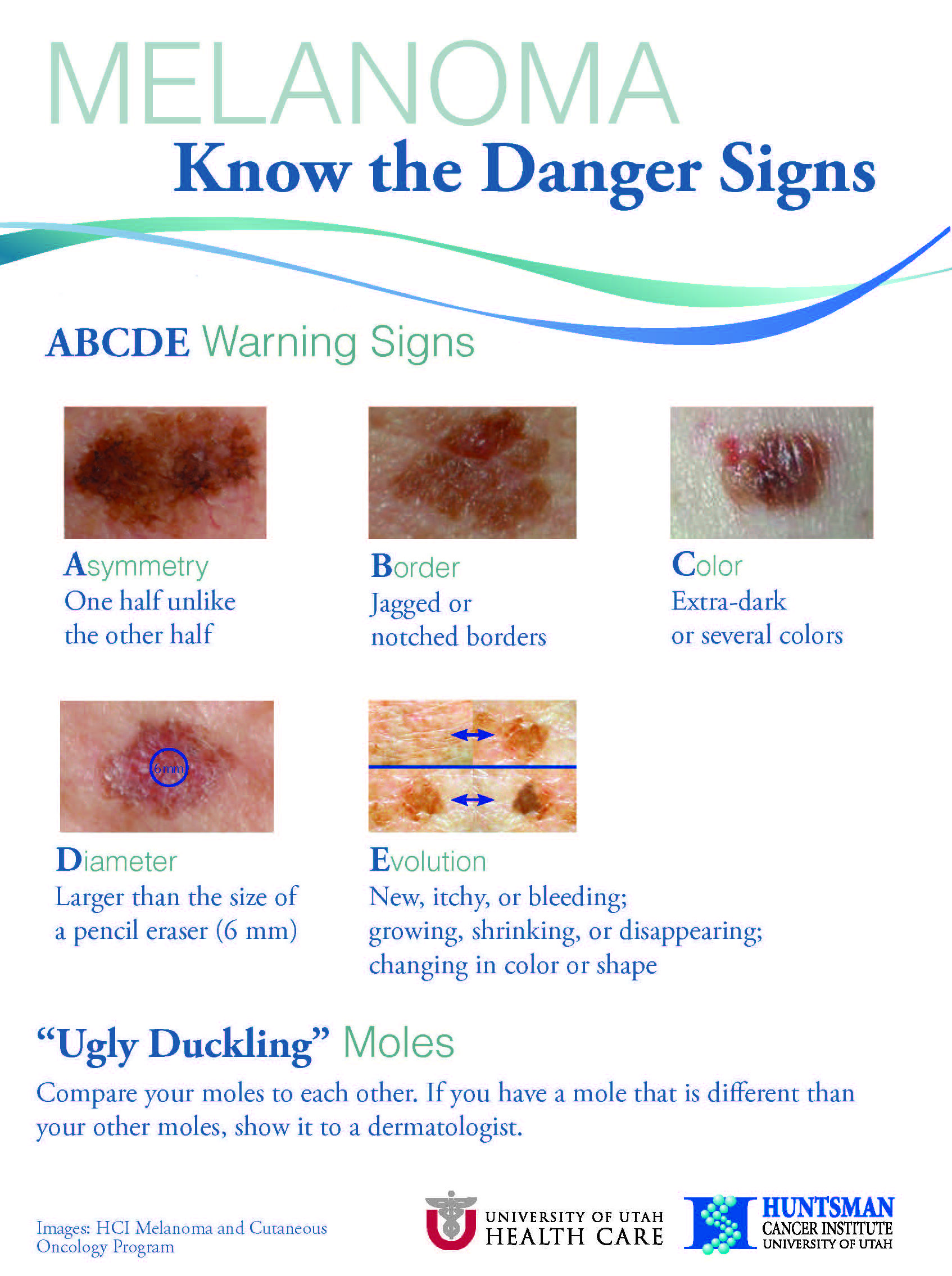 5 Warning Signs Of Skin Cancer