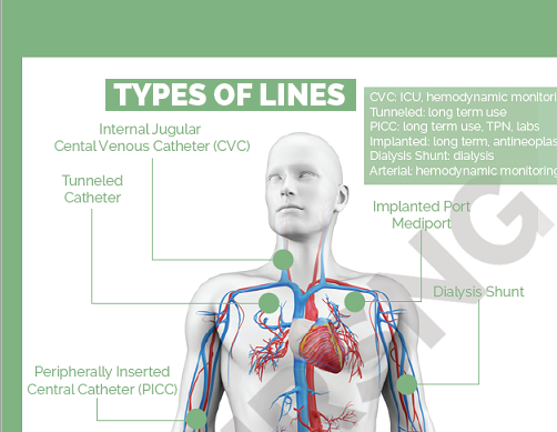 Central Venous Catheters (Central Lines) Cheat Sheet - Medical eStudy ...