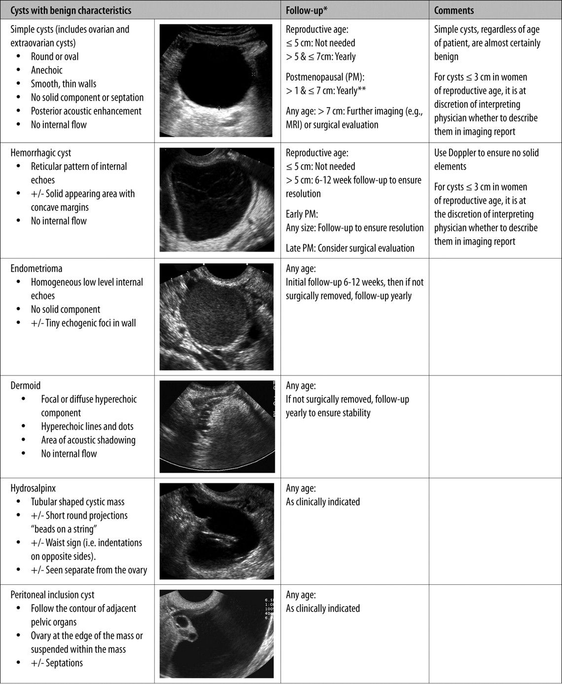 Simple Ovarian Cyst Ultrasound