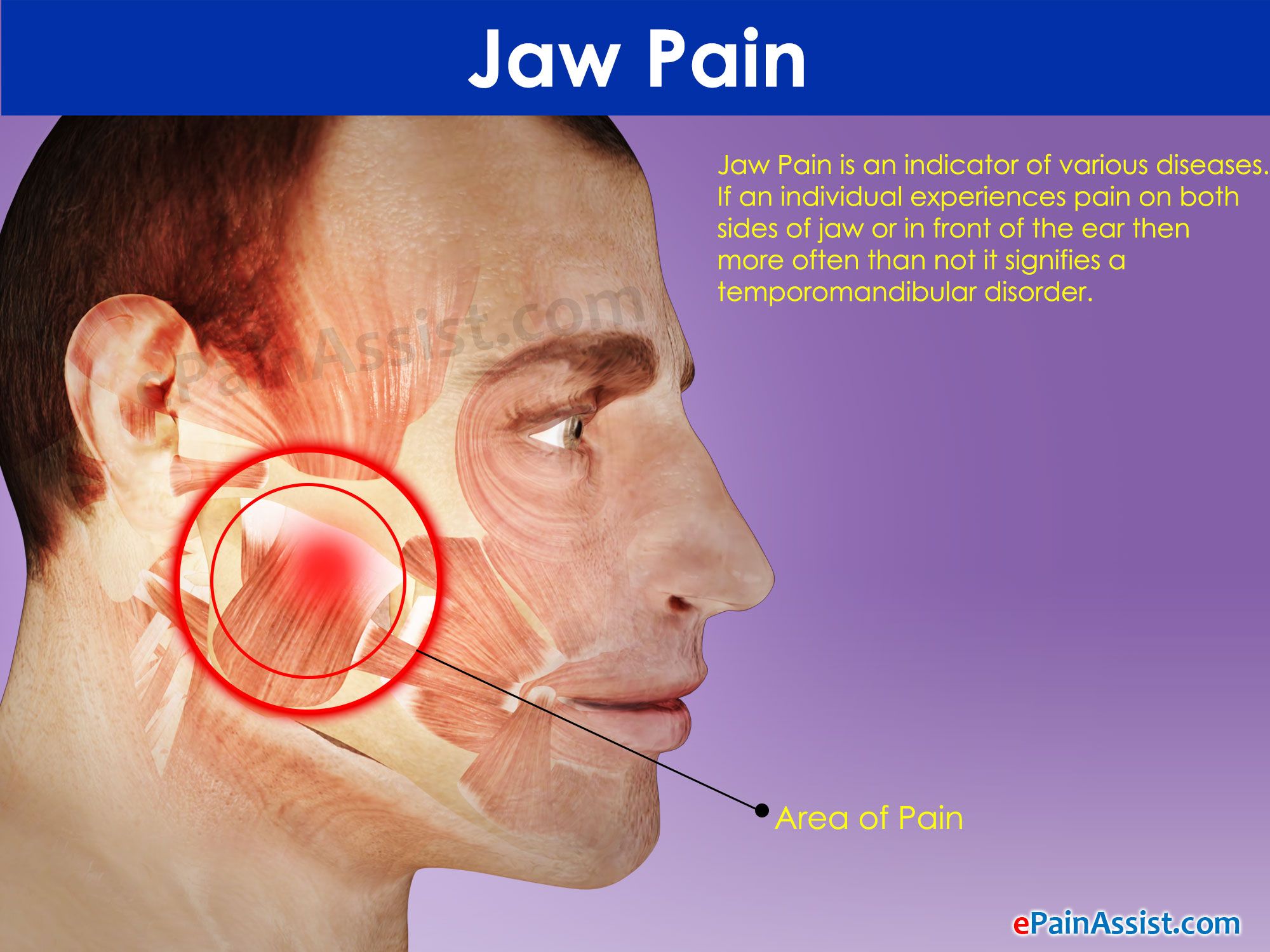 Tooth Pain Under Cheekbone at Mary Pierce blog