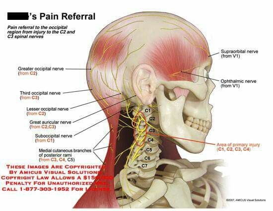 Third occipital nerve headache images | aboutheadache