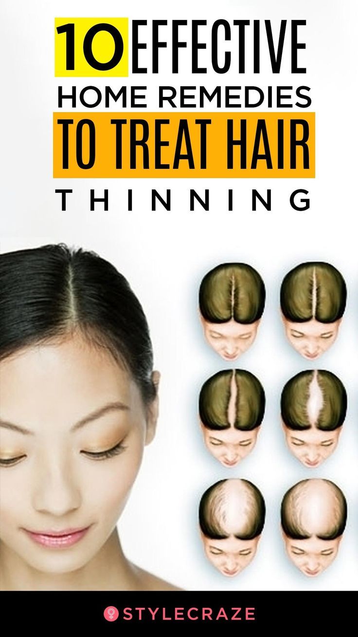 10 Home Remedies And Prevention Tips To Treat Thinning Hair Treat