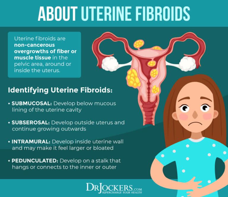 Uterine Polyps, Uterine Fibroids Symptoms, Uterine Fibroids Treatment ...