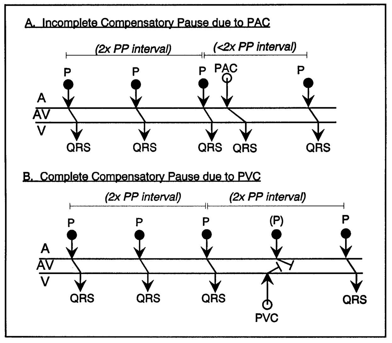 ECG Learning Center - An introduction to clinical electrocardiography ...